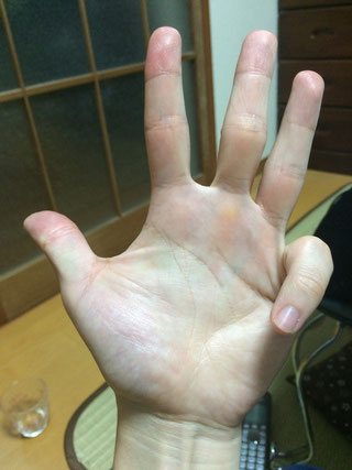 簡単 ギターの薬指と小指の分離法 府中ギター教室 スクール ハヤタギター教室 簡単 ギターの薬指と小指の分離法 府中ギター教室 スクール ハヤタギター教室